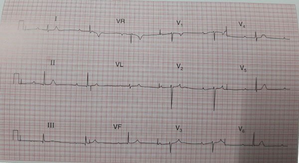 ecg-practise-examples-as-academy