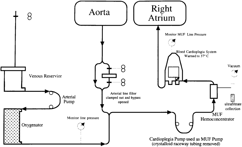 CBP Diagram